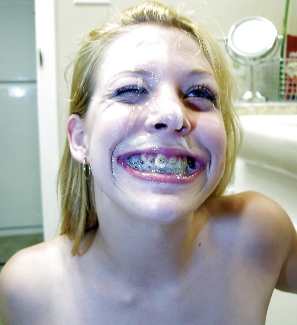 Girls with braces fucked