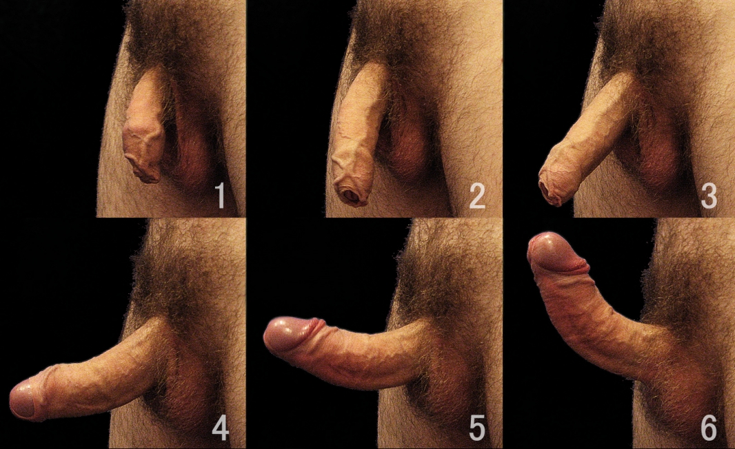 Large and small penises
