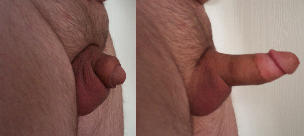Little cropped penis