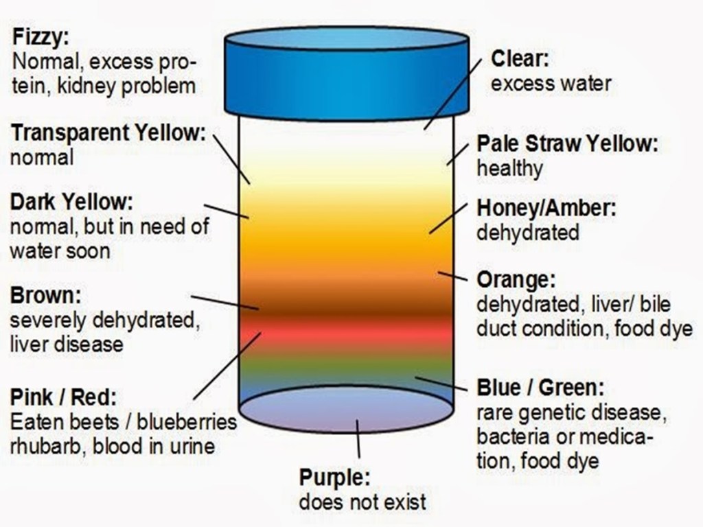 Color urine Colorless